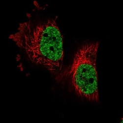 PARPBP Antibody, Novus Biologicals:Antibodies:Primary Antibodies